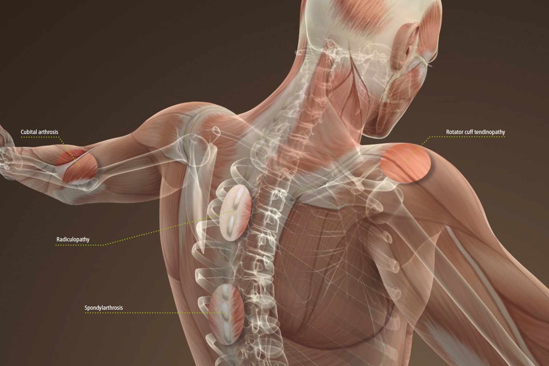 HelloPhysio Extracorporeal Magnetotransduction Therapy Physio Treatment lower back pain or tendinopathies of rotator cuff or Achilles tendon HelloPhysio Extracorporeal Magnetotransduction Therapy Physio Treatment lower back pain or tendinopathies of rotator cuff or Achilles tendon