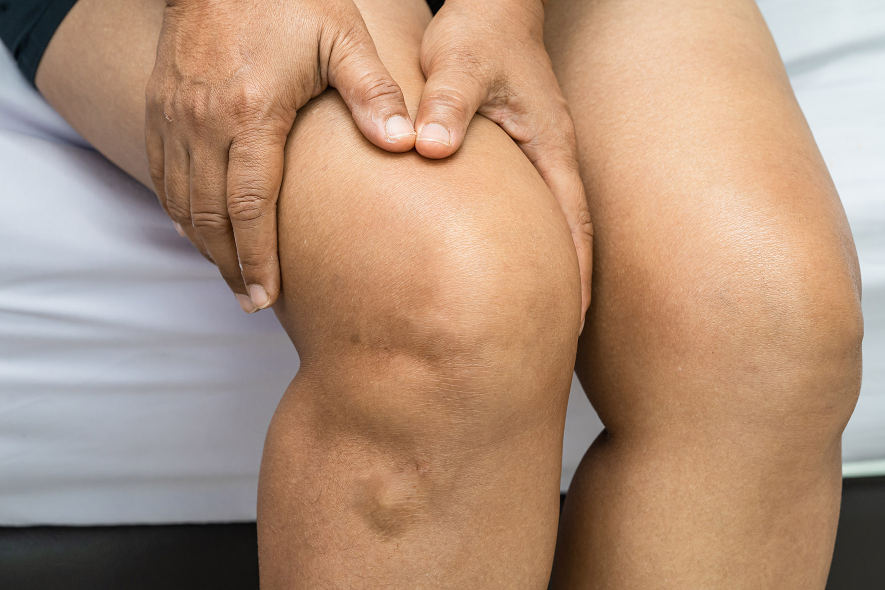 Osgood-Schlatter disease in adults