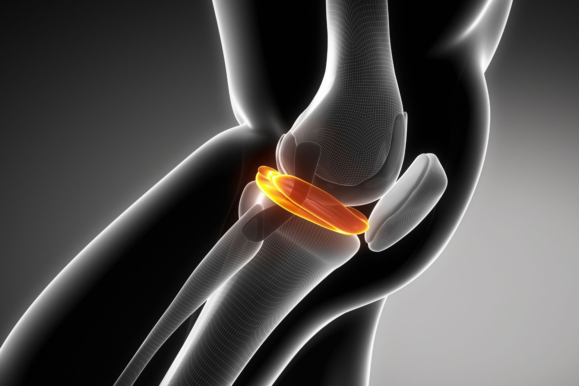 understanding meniscus injury