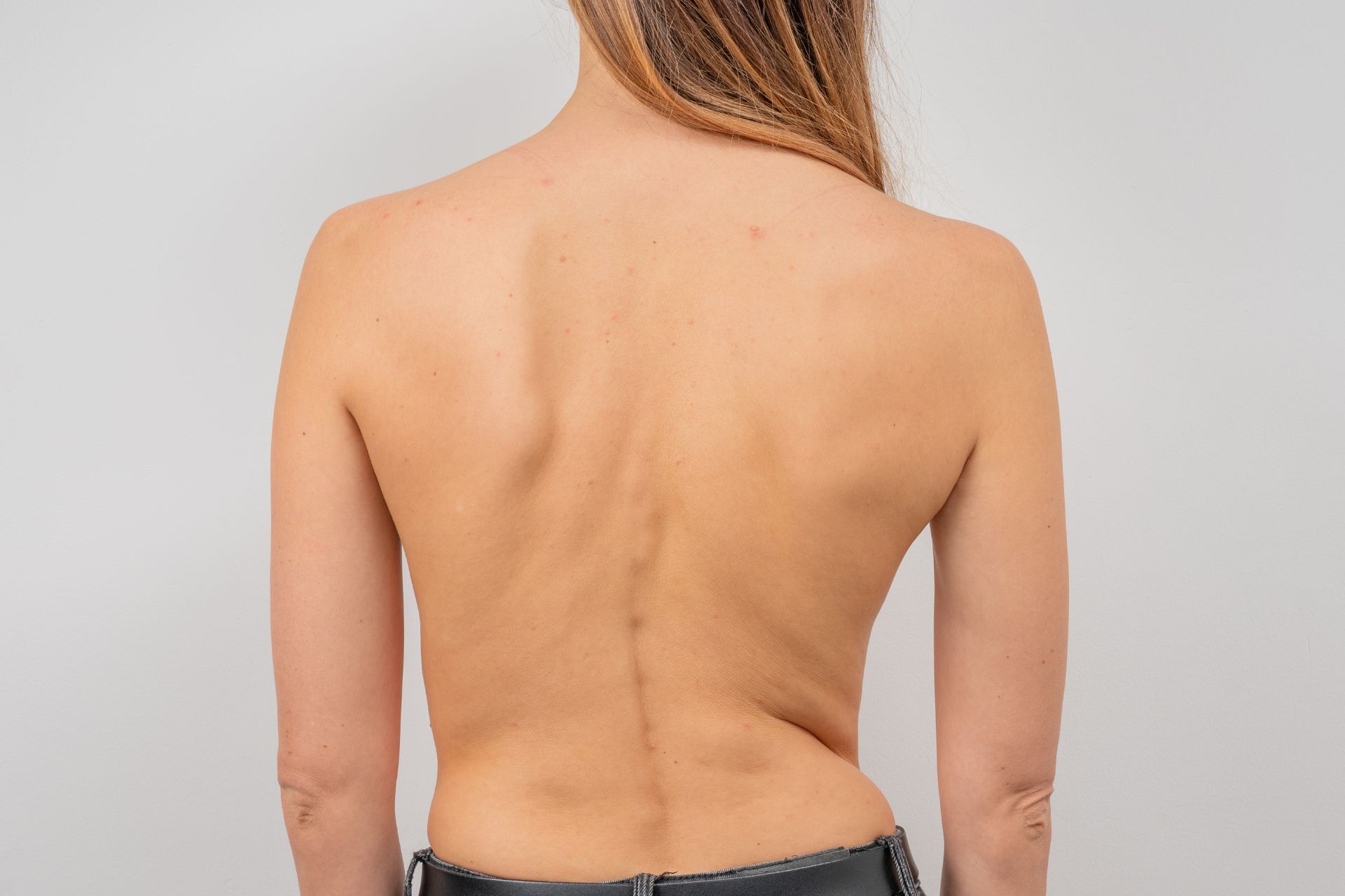 scoliosis diagnosis in Singapore